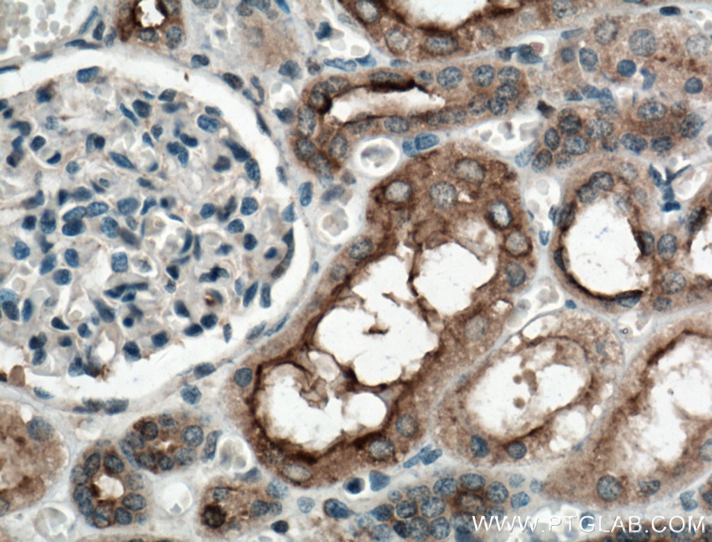 Immunohistochemistry (IHC) staining of human kidney tissue using TPK1 Polyclonal antibody (10942-1-AP)