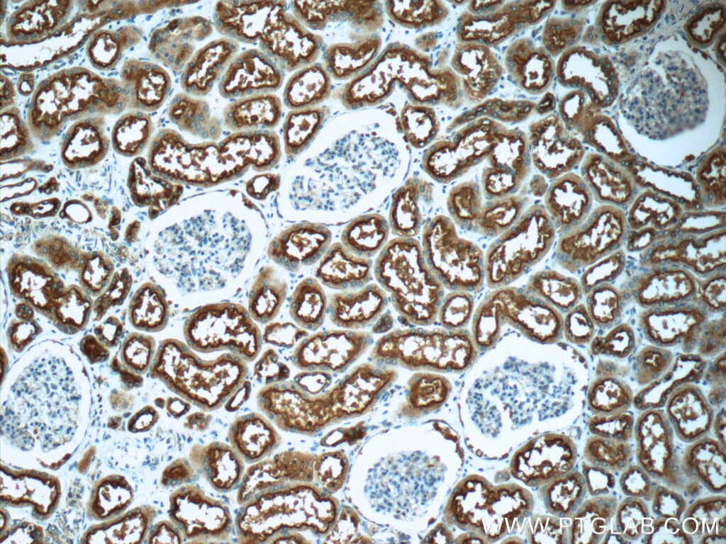 Immunohistochemistry (IHC) staining of human kidney tissue using TPK1 Polyclonal antibody (10942-1-AP)