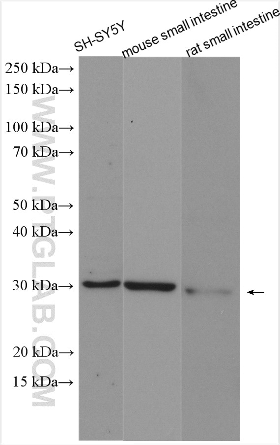 Western Blot (WB) analysis of various lysates using TPK1 Polyclonal antibody (10942-1-AP)
