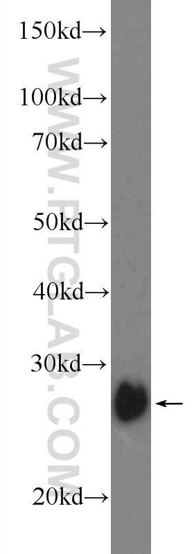 Western Blot (WB) analysis of mouse kidney tissue using TPK1 Polyclonal antibody (10942-1-AP)