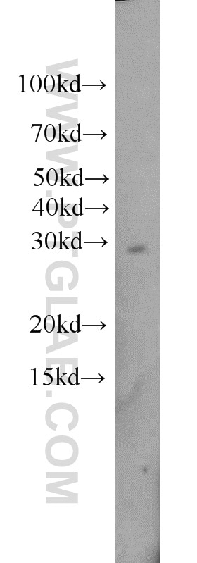 Western Blot (WB) analysis of L02 cells using TPK1 Polyclonal antibody (10942-1-AP)