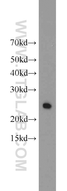 Western Blot (WB) analysis of mouse small intestine tissue using TPK1 Polyclonal antibody (10942-1-AP)