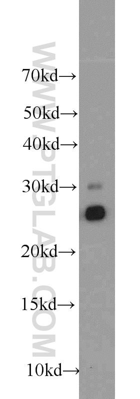 Western Blot (WB) analysis of mouse kidney tissue using TPK1 Polyclonal antibody (10942-1-AP)