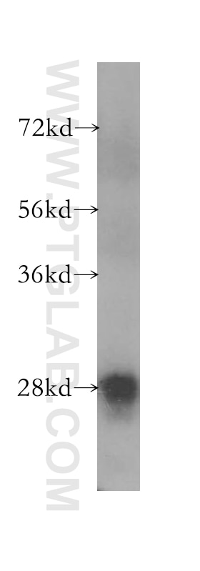 Western Blot (WB) analysis of human small intestine tissue using TPK1 Polyclonal antibody (10942-1-AP)