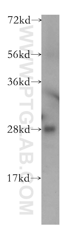 Western Blot (WB) analysis of mouse testis tissue using TPK1 Polyclonal antibody (10942-1-AP)