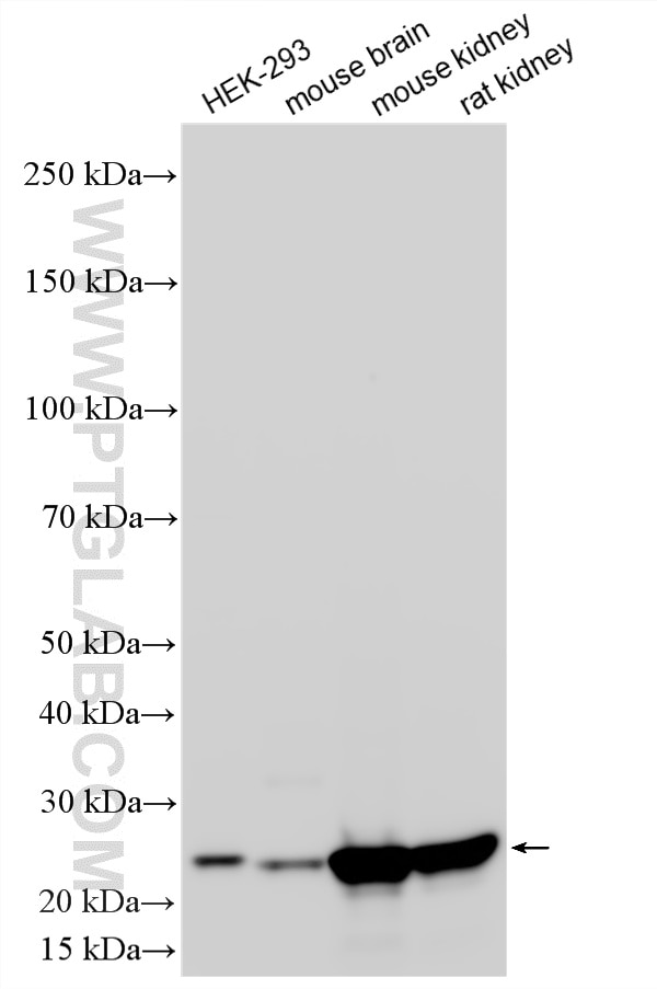 WB analysis using RMX00090 Western Blot (WB) analysis of various lysates using Multi-rAb® TPK1 Multi-Recombinant antibody (RMX00090)