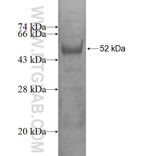 TPK1 fusion protein Ag1404 SDS-PAGE