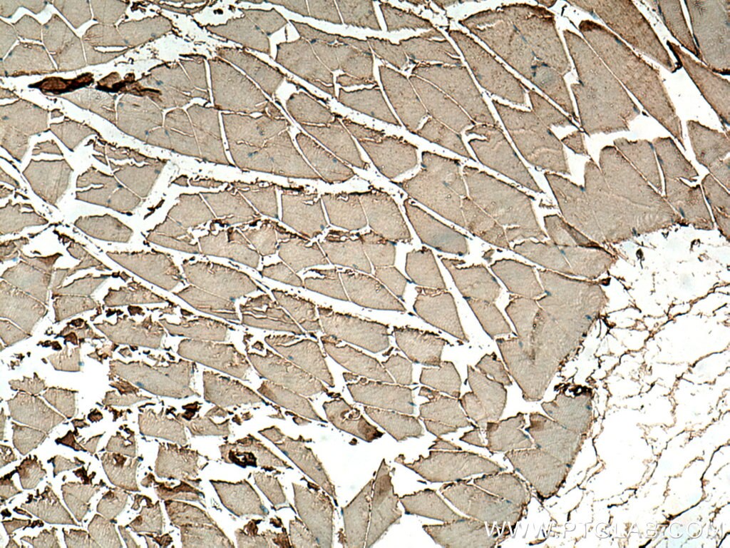 Immunohistochemistry (IHC) staining of mouse skeletal muscle tissue using TPM1 Polyclonal antibody (28477-1-AP)