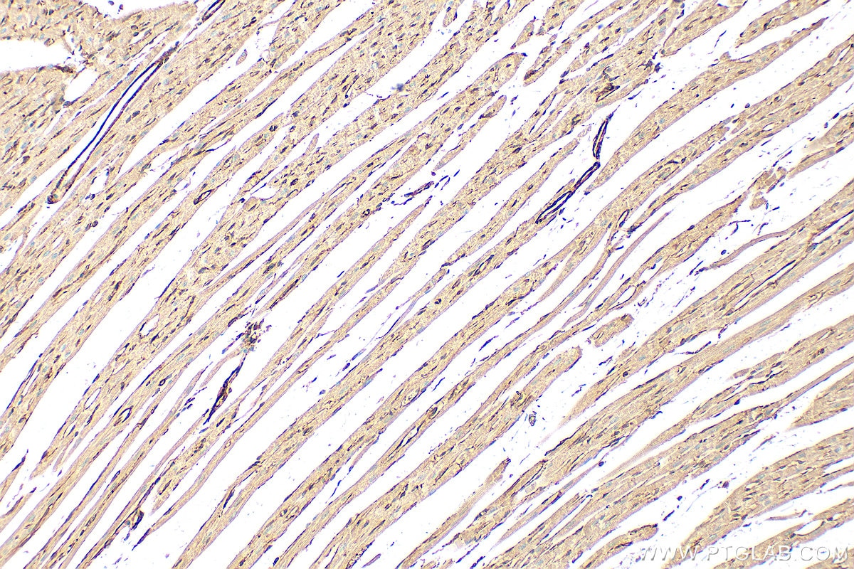 Immunohistochemical analysis of paraffin-embedded rat heart tissue slide using 28477-1-AP (TPM1 antibody) at dilution of 1:1000 (under 10x lens). Heat mediated antigen retrieval with Tris-EDTA buffer (pH 9.0). Immunohistochemistry (IHC) staining of rat heart tissue using TPM1 Polyclonal antibody (28477-1-AP)