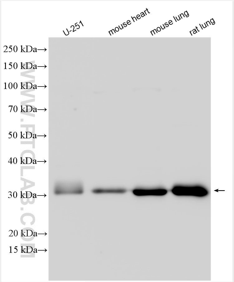 Western Blot (WB) analysis of various lysates using TPM1 Polyclonal antibody (28477-1-AP)