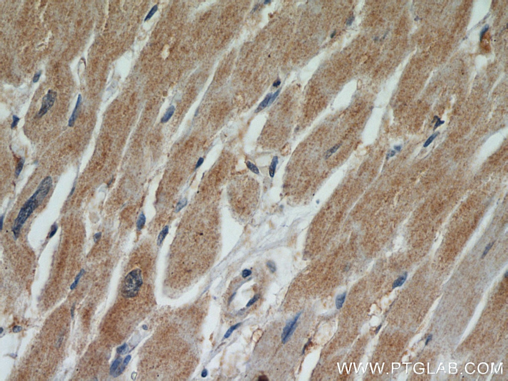 Immunohistochemistry (IHC) staining of human heart tissue using TPM2 Polyclonal antibody (11038-1-AP)