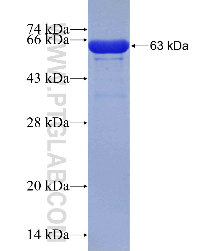 TPM2 fusion protein Ag1508 SDS-PAGE