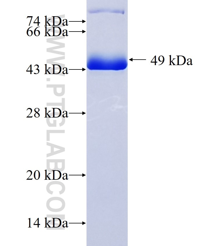 TPM2 fusion protein Ag17362 SDS-PAGE TPM2 fusion protein Ag17362 SDS-PAGE