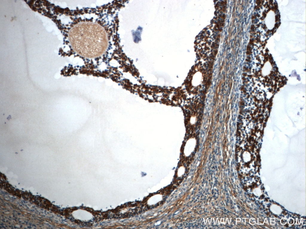 Immunohistochemistry (IHC) staining of human ovary tissue using TPM3 Polyclonal antibody (10737-1-AP)