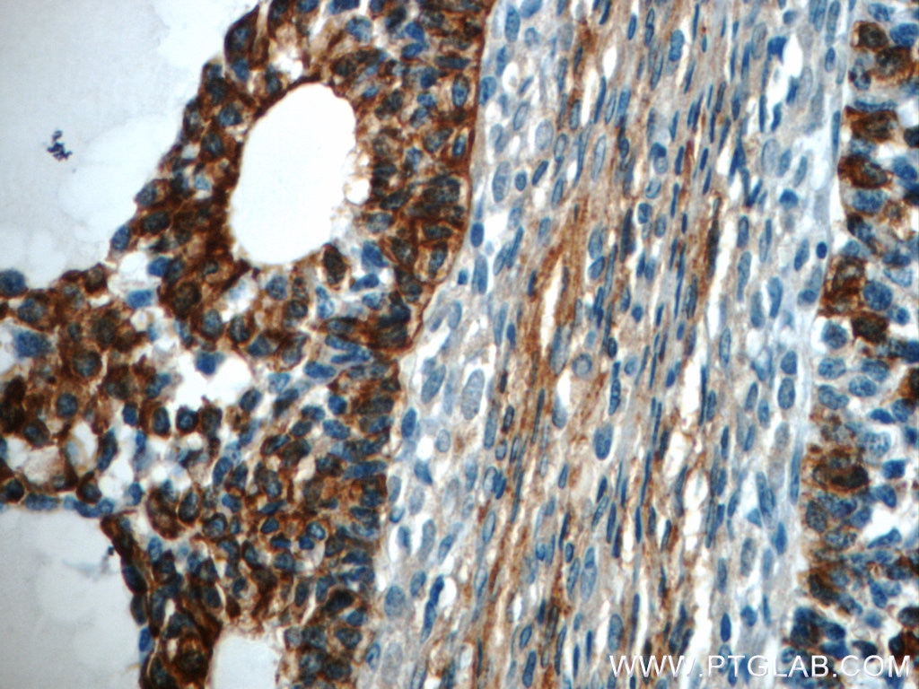 IHC staining of human ovary using 10737-1-AP