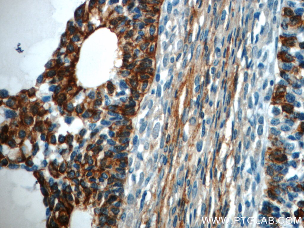 Immunohistochemistry (IHC) staining of human ovary tissue using TPM3 Polyclonal antibody (10737-1-AP)