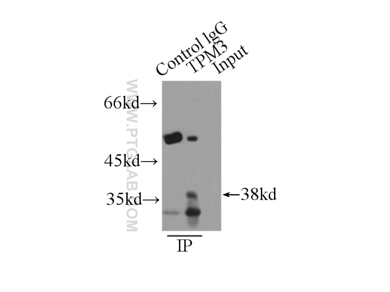 Immunoprecipitation (IP) experiment of HeLa cells using TPM3 Polyclonal antibody (10737-1-AP)