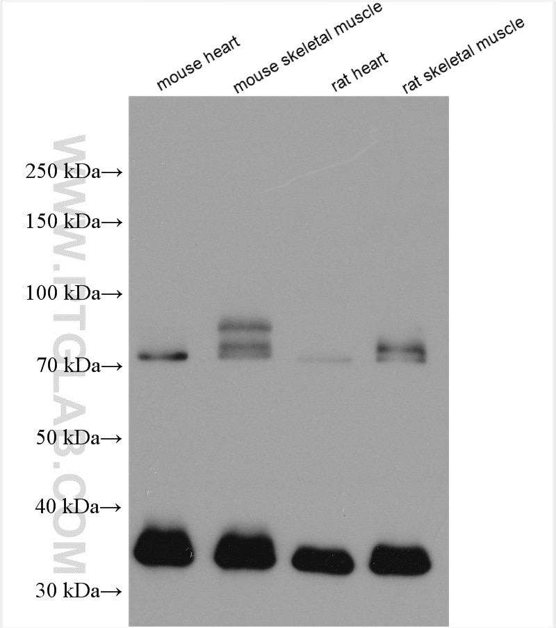 Western Blot (WB) analysis of various lysates using TPM3 Polyclonal antibody (10737-1-AP)