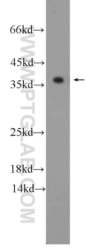 Western Blot (WB) analysis of mouse heart tissue using TPM3 Polyclonal antibody (10737-1-AP)