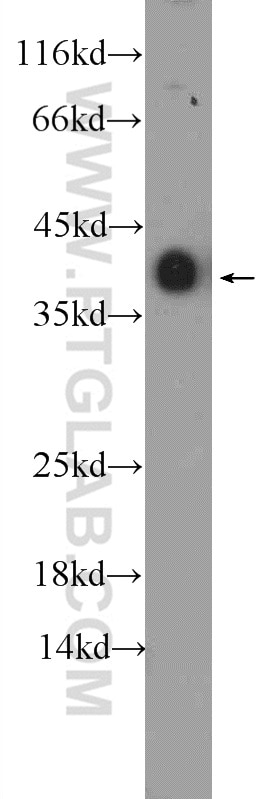 Western Blot (WB) analysis of rat heart tissue using TPM3 Polyclonal antibody (10737-1-AP)