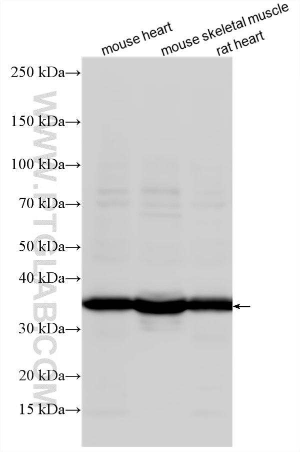Western Blot (WB) analysis of various lysates using TPM3 Polyclonal antibody (10737-1-AP)