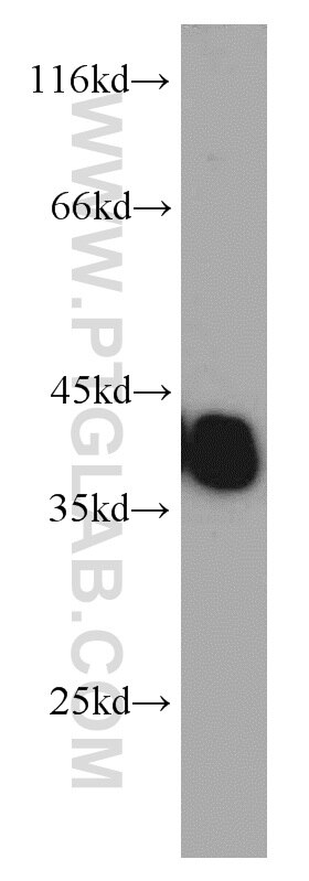 Western Blot (WB) analysis of mouse skeletal muscle tissue using TPM3 Polyclonal antibody (10737-1-AP)