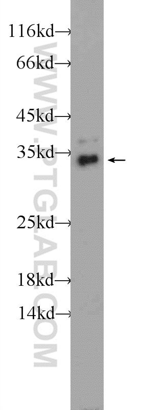 Western Blot (WB) analysis of HeLa cells using TPM3 Polyclonal antibody (10737-1-AP)