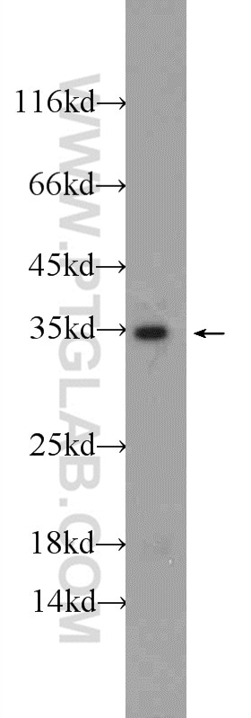 Western Blot (WB) analysis of HEK-293 cells using TPM3 Polyclonal antibody (10737-1-AP)