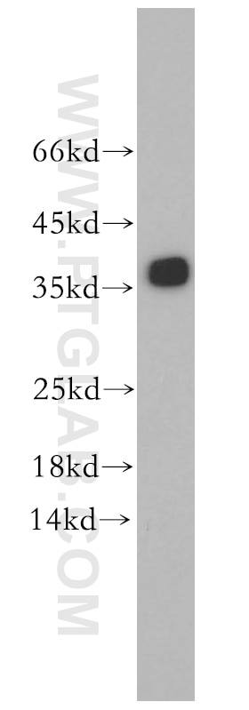 Western Blot (WB) analysis of mouse skeletal muscle tissue using TPM3 Polyclonal antibody (10737-1-AP)