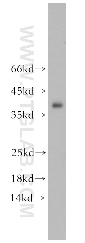 Western Blot (WB) analysis of human heart tissue using TPM3 Polyclonal antibody (10737-1-AP)