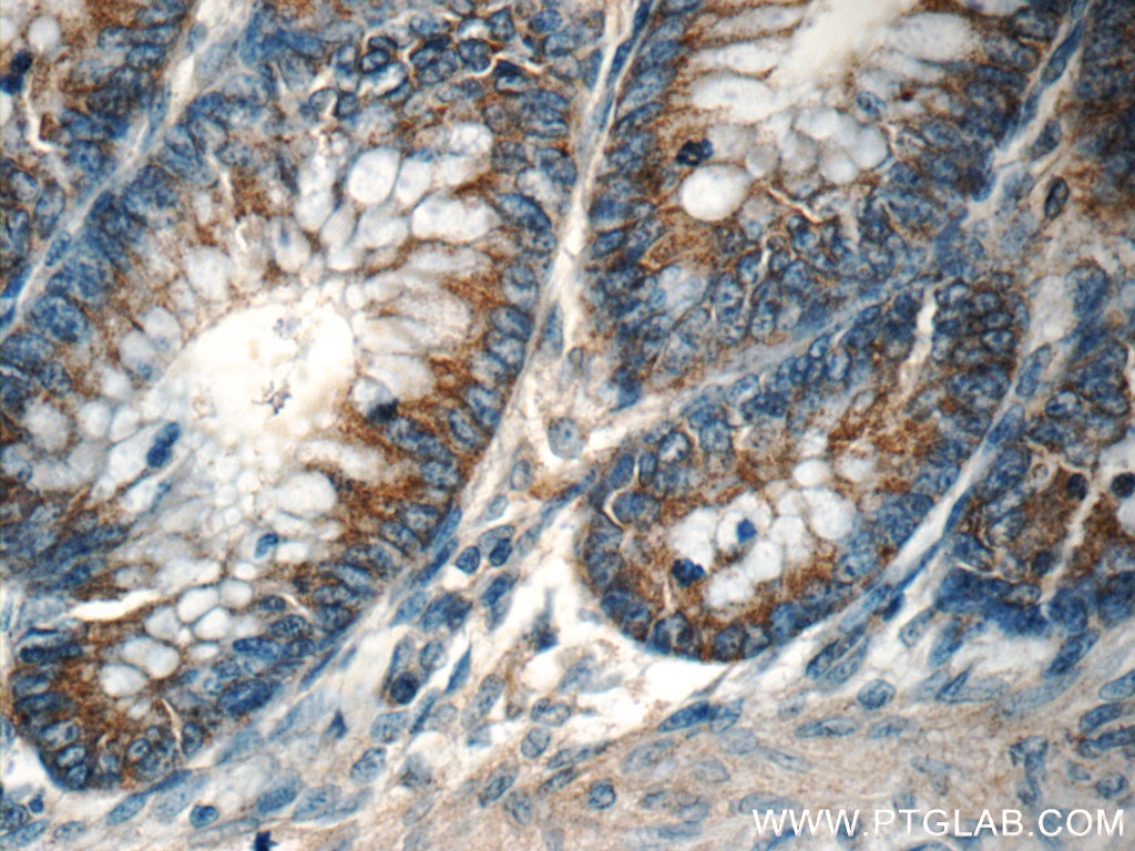 Immunohistochemistry (IHC) staining of human colon tissue using TPM3 Polyclonal antibody (55444-1-AP)