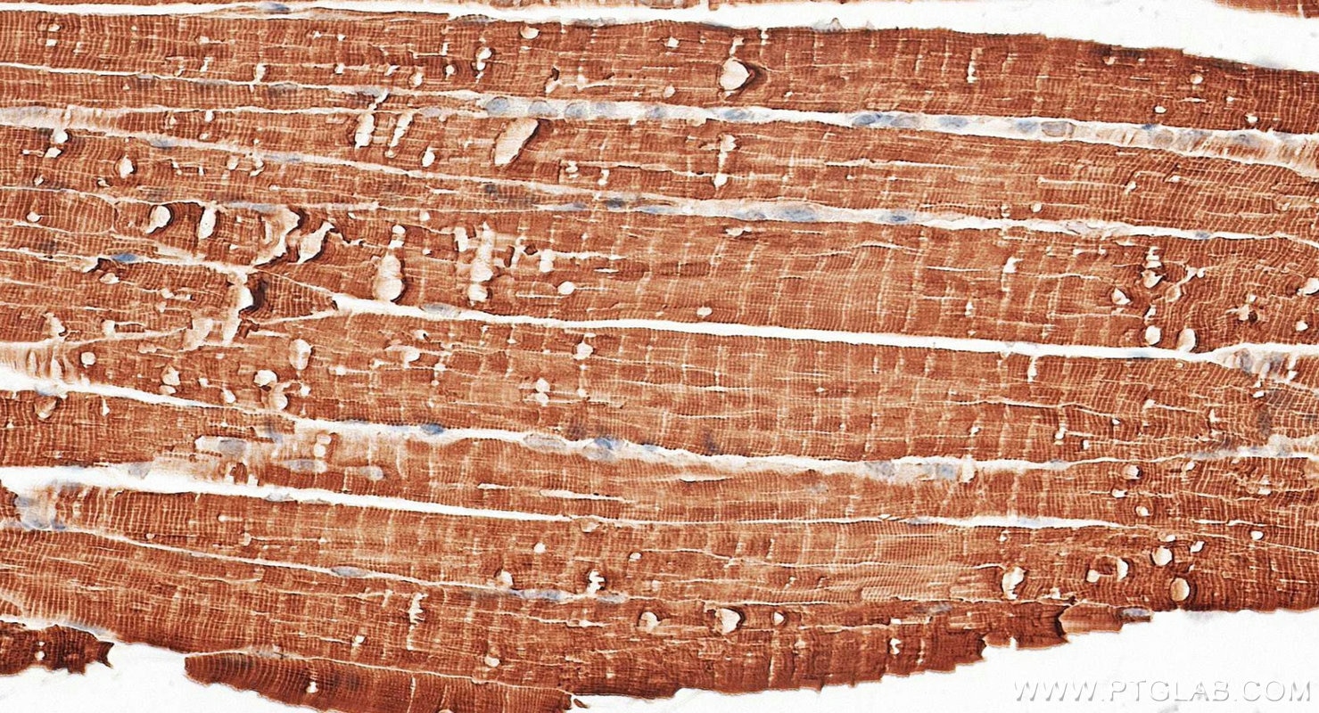 Immunohistochemistry (IHC) staining of mouse skeletal muscle tissue using TPM3 Monoclonal antibody (68158-1-Ig)