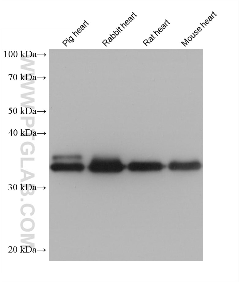 Western Blot (WB) analysis of various lysates using TPM3 Monoclonal antibody (68158-1-Ig)