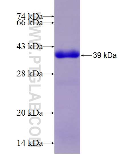 TPM3 fusion protein Ag28568 SDS-PAGE