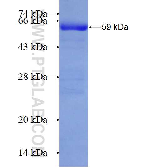 TPM3 fusion protein Ag1171 SDS-PAGE