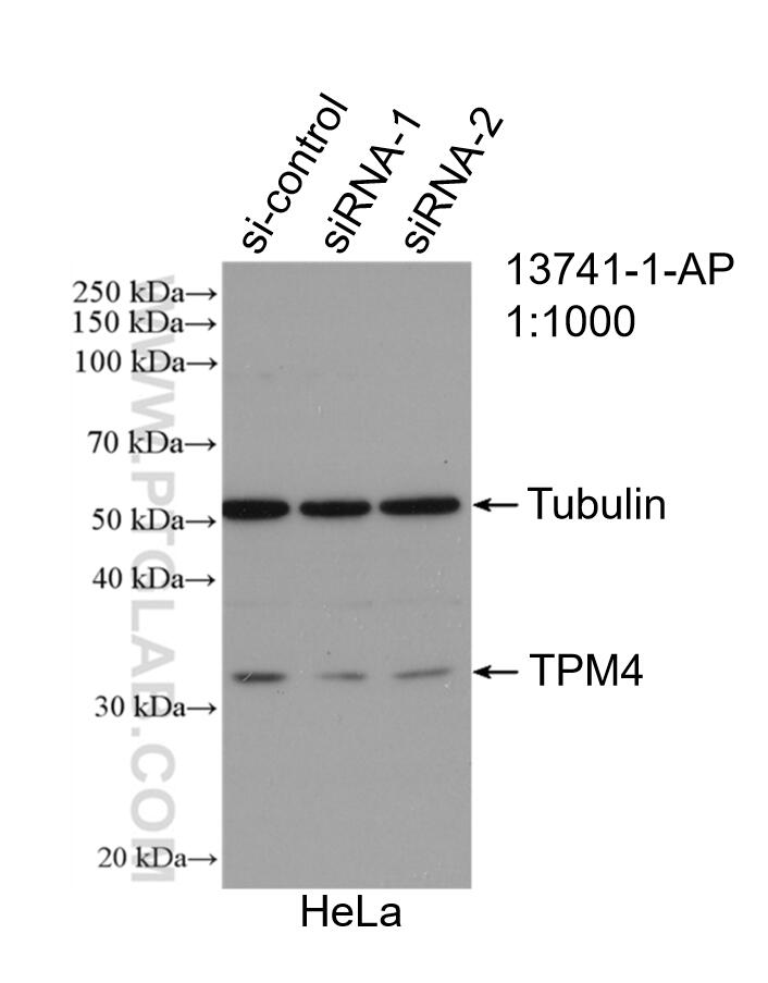 Western Blot (WB) analysis of HeLa cells using TPM4 Polyclonal antibody (13741-1-AP)