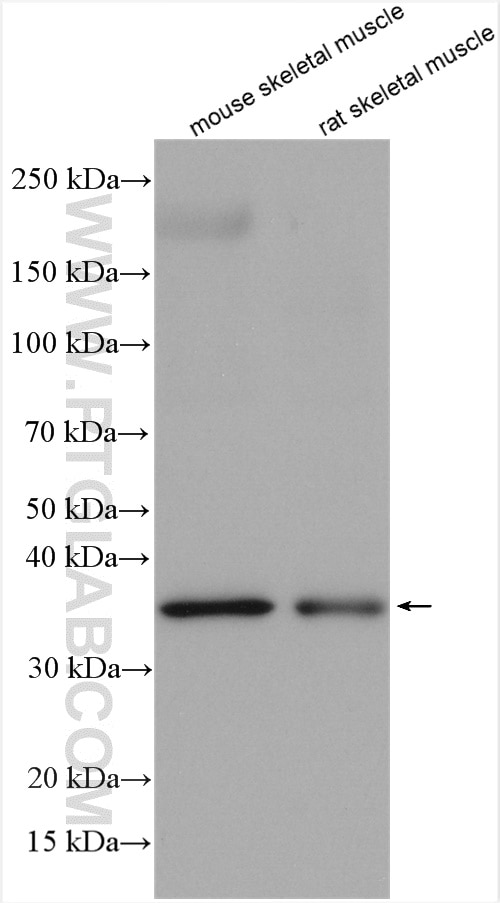 Western Blot (WB) analysis of various lysates using TPM4 Polyclonal antibody (13741-1-AP)