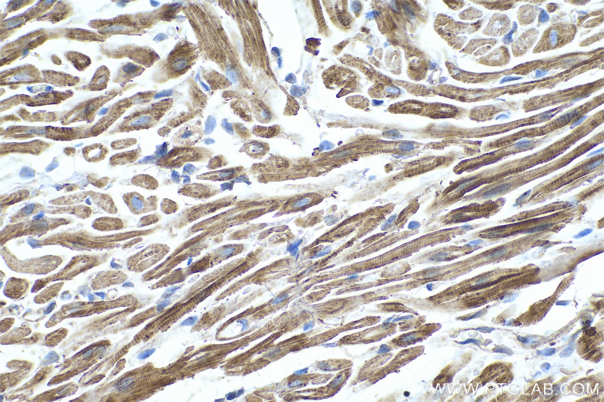 Immunohistochemistry (IHC) staining of rat heart tissue using TPM4 Monoclonal antibody (67244-1-Ig)