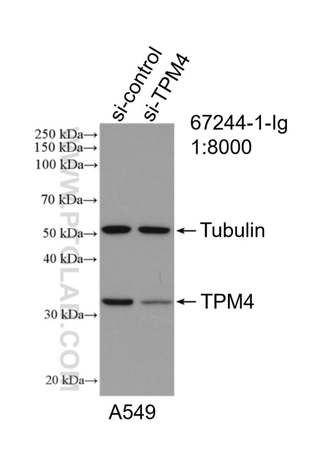 WB analysis of A549 using 67244-1-Ig