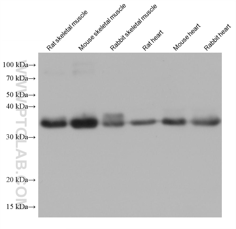 Western Blot (WB) analysis of various lysates using TPM4 Monoclonal antibody (67244-1-Ig)
