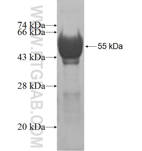 TPM4 fusion protein Ag4679 SDS-PAGE