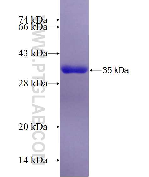 TPM4 fusion protein Ag6947 SDS-PAGE