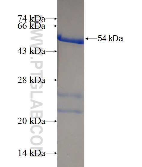 TPMT fusion protein Ag1074 SDS-PAGE