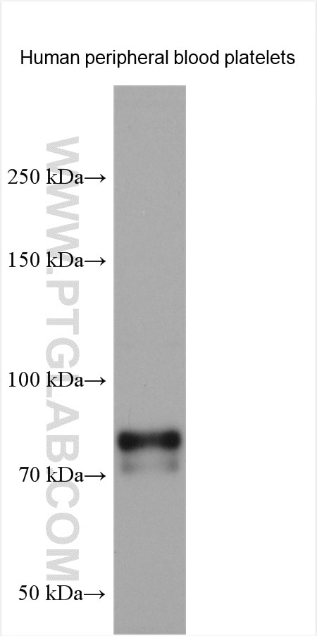Western Blot (WB) analysis of various lysates using TPOR/MPL  Polyclonal antibody (24760-1-AP)