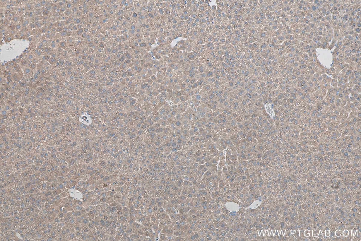 Immunohistochemistry (IHC) staining of mouse liver tissue using TPP1 Polyclonal antibody (12479-1-AP)