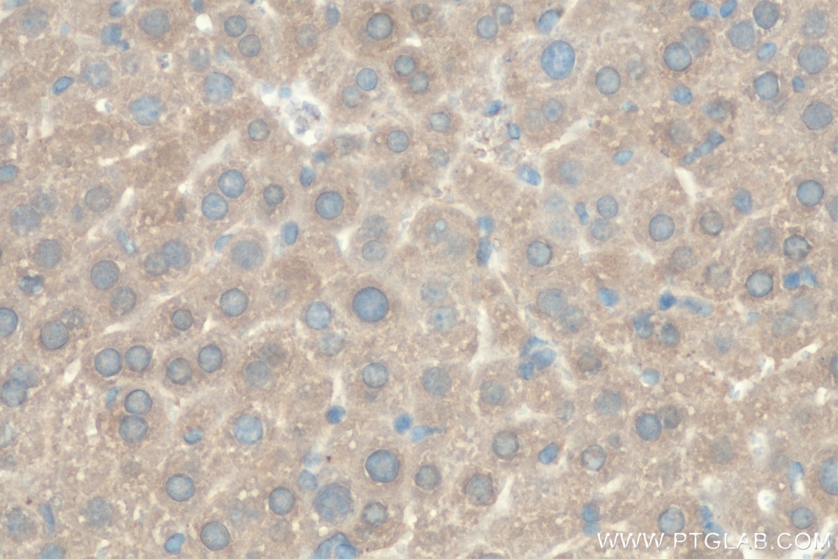 Immunohistochemistry (IHC) staining of mouse liver tissue using TPP1 Polyclonal antibody (12479-1-AP)