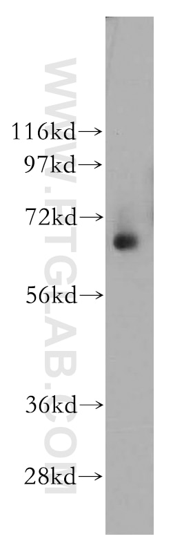 Western Blot (WB) analysis of human colon tissue using TPP1 Polyclonal antibody (12479-1-AP)