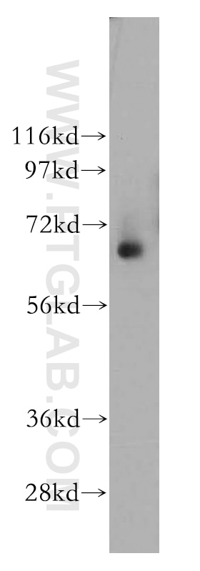 WB analysis of human colon using 12479-1-AP