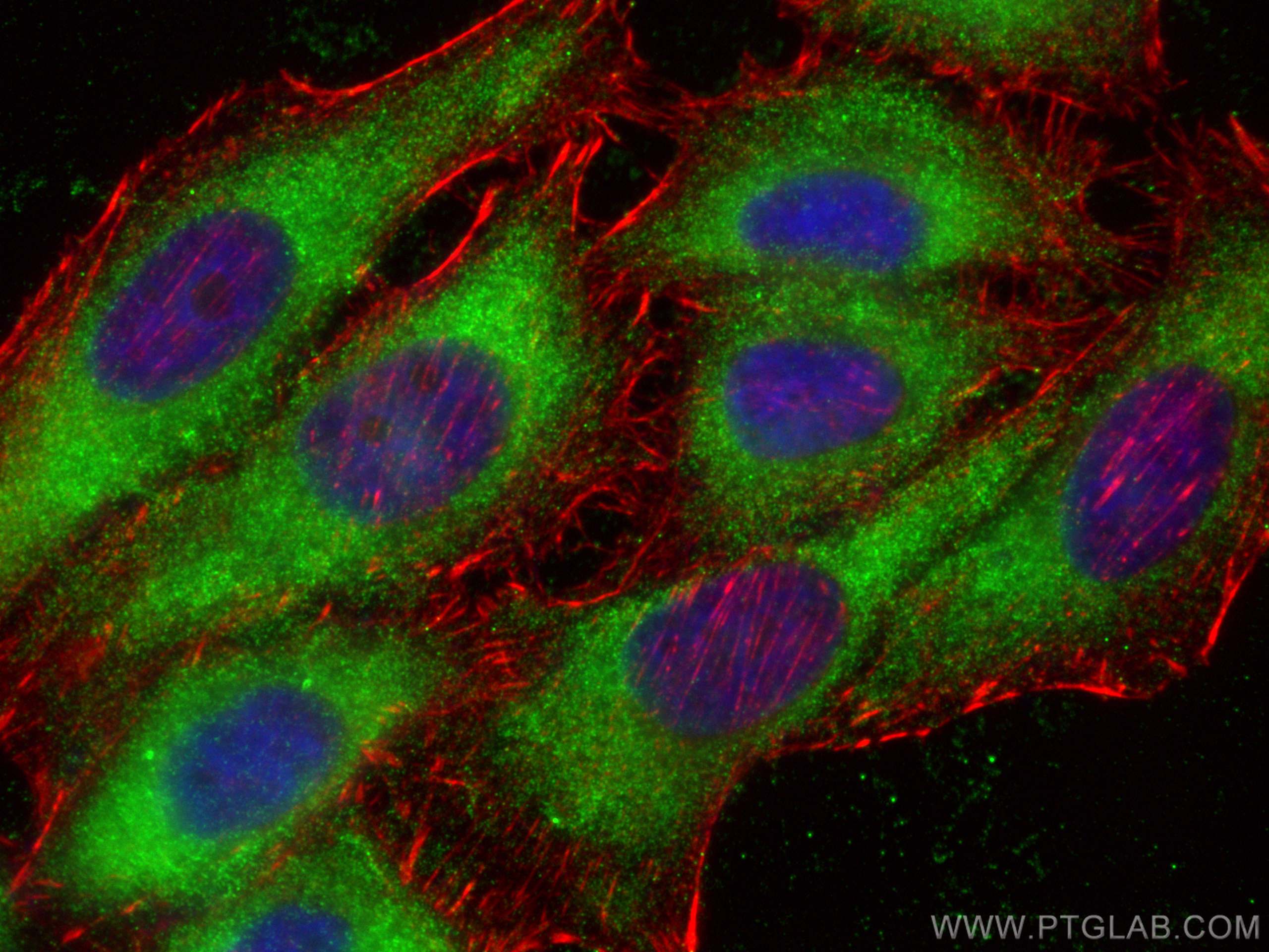 Immunofluorescence (IF) / fluorescent staining of HepG2 cells using TPPII Polyclonal antibody (14120-1-AP)