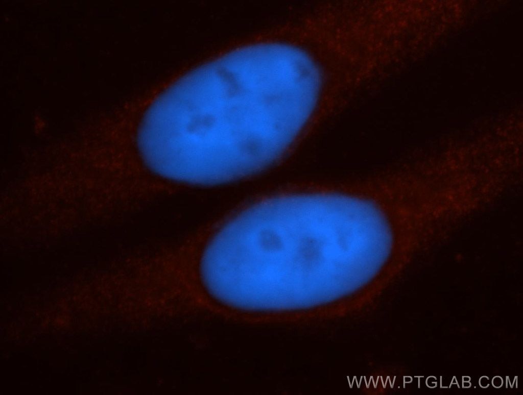Immunofluorescence (IF) / fluorescent staining of HepG2 cells using TPPII Polyclonal antibody (14120-1-AP)